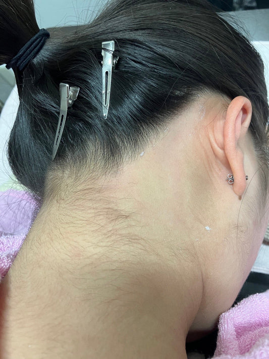 成人式前のうなじ処理WAX脱毛人気です☆